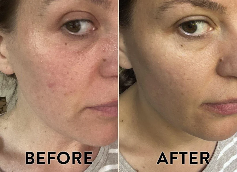 CBD Superboost Face Oil
